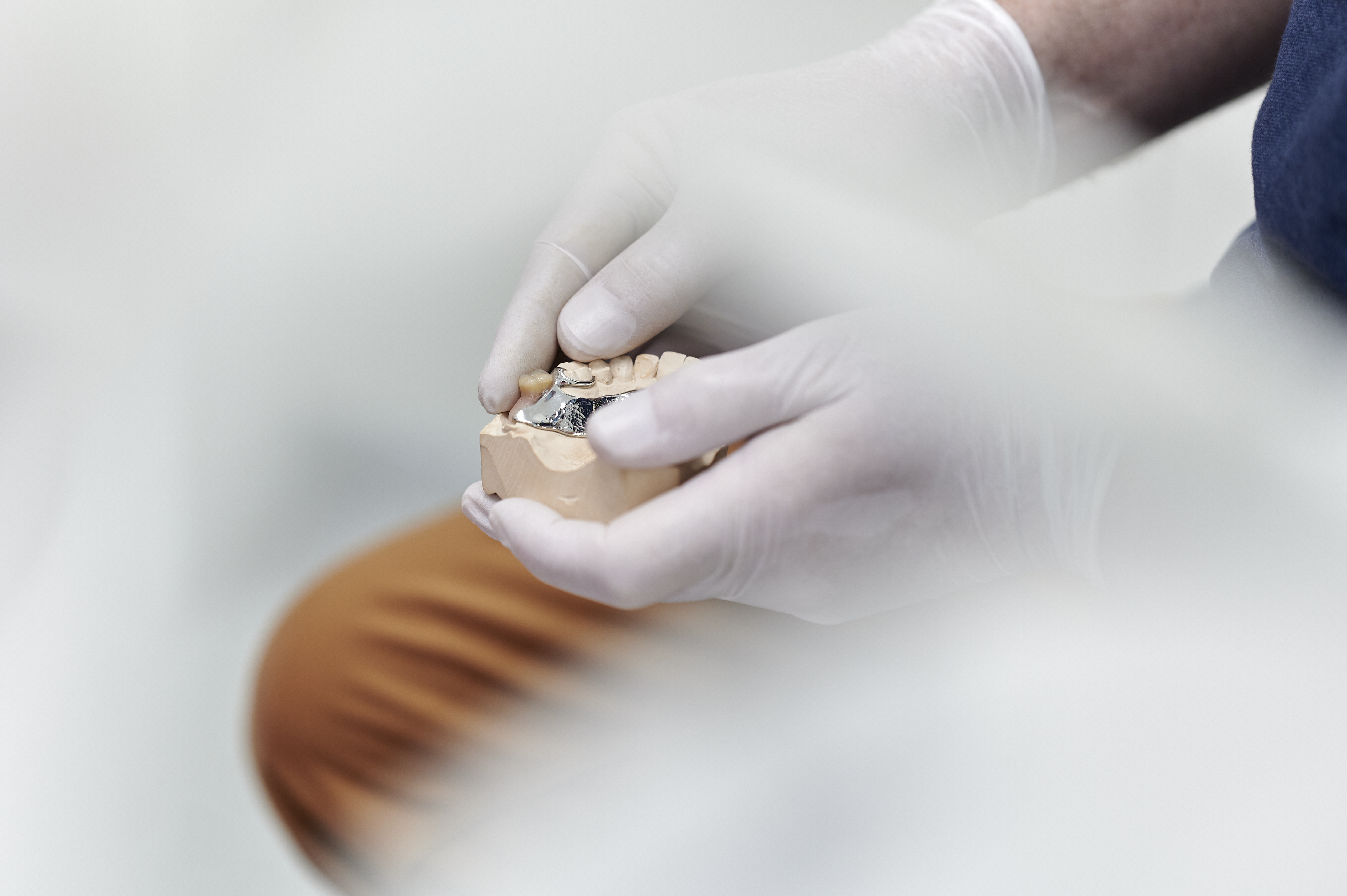 Prothèses dentaires fixes et amovibles à Liège​​